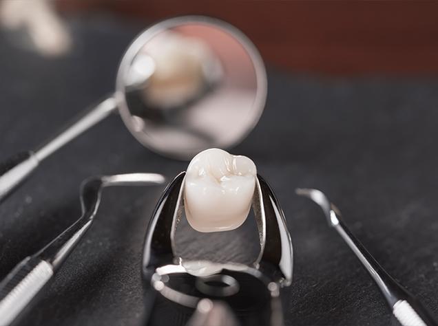 Oral Surgery | Redtree Dental | Vancouver General & Family Dentist