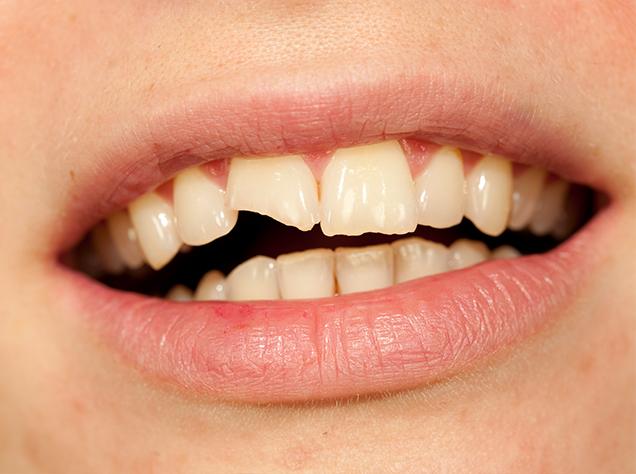 Symptoms of a Dental Emergency | Redtree Dental | Vancouver General Dentist