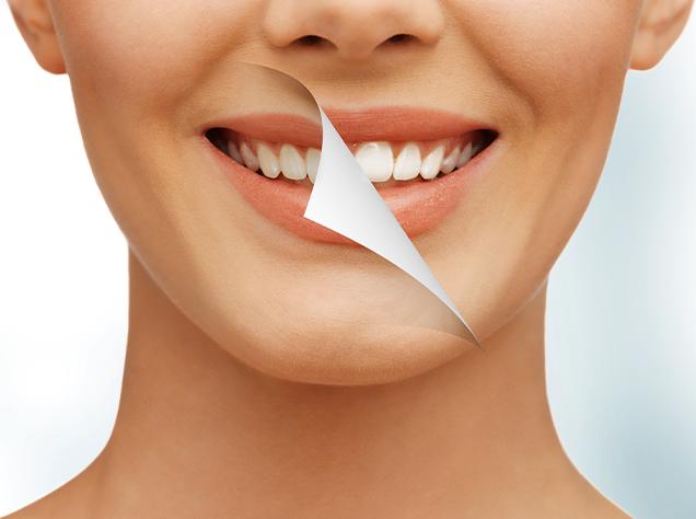 What is Teeth Whitening | Redtree Dental | Vancouver General Dentist