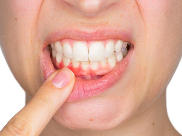 Fotona Lightwalker Hard and Soft Tissue | Redtree Dental | Vancouver General & Family Dentist
