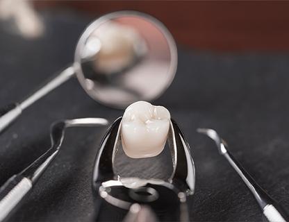 Oral Surgery Treatment | Redtree Dental | Vancouver General & Family Dentist