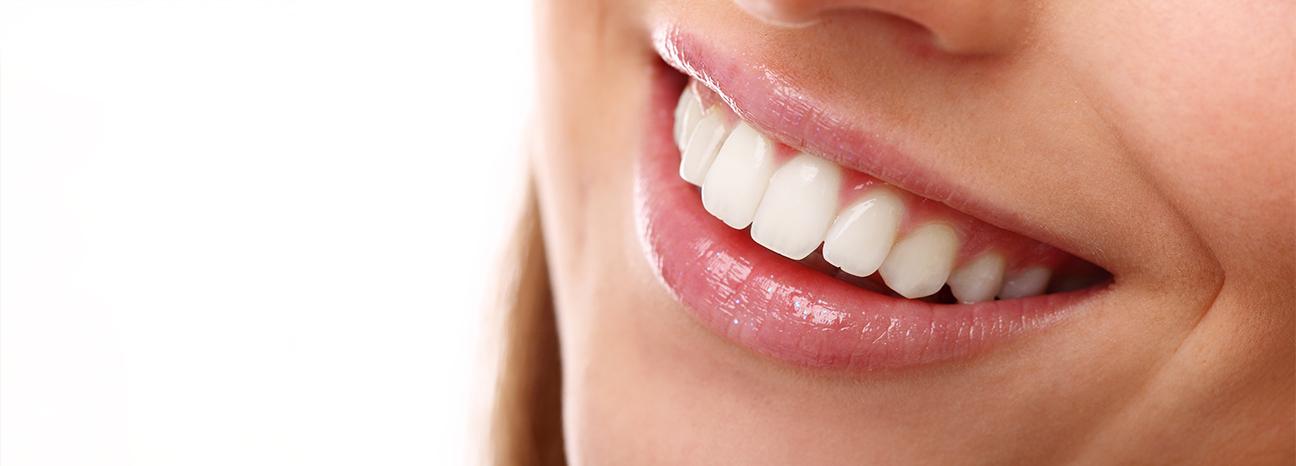 Smile Makeover | Redtree Dental | Vancouver General & Family Dentist