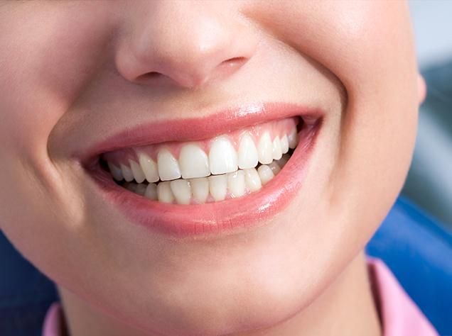 Smile Makeover Dentist | Redtree Dental | Vancouver General & Family Dentist