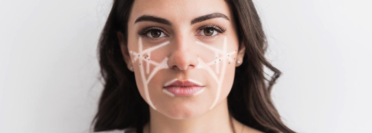Therapeutic Dysport Botox Xeomin | Redtree Dental | Vancouver General & Family Dentist