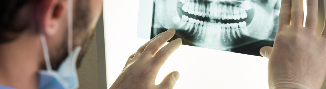 How Often Should You Visit the Dentist